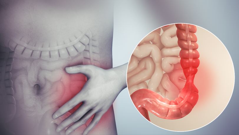 شخص يضع يده اليسرى اسفل بطنه من جهة الشمال ويظهر بجانب يده صورة توضيحية للقولون العصبي