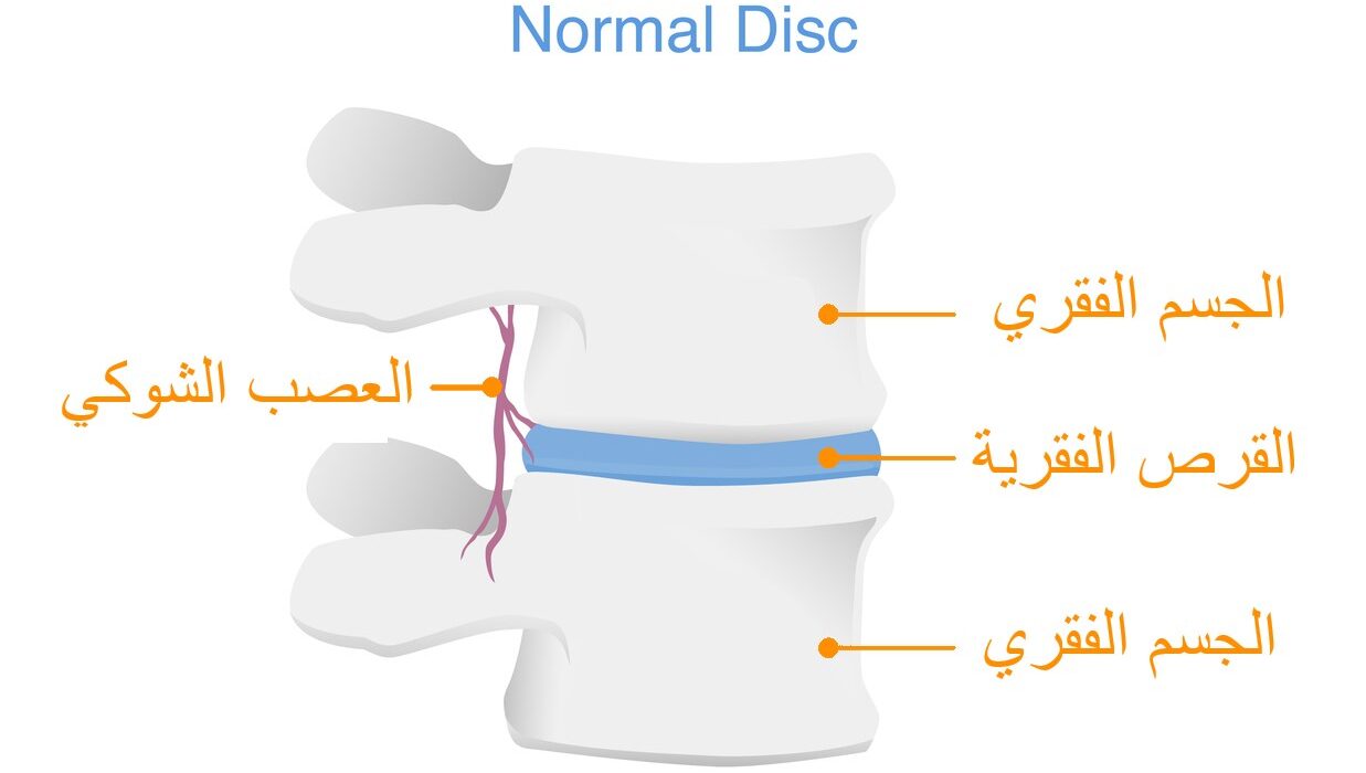 رسم توضيحي لمقطع طولي لفقرتين في العمود الفقري عند الإنسان وتظهر القرص الفقرية بين الفقرات