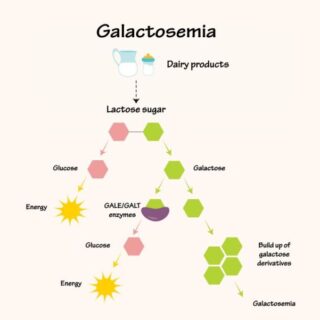 رسم توضيحي لتفاعل الغالاكتوزيميا