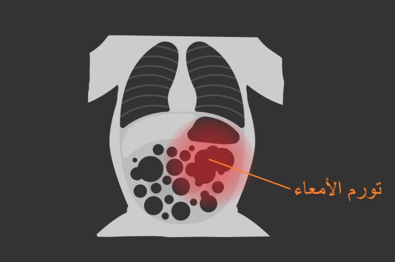 صورة أشعة سينية للأمعاء