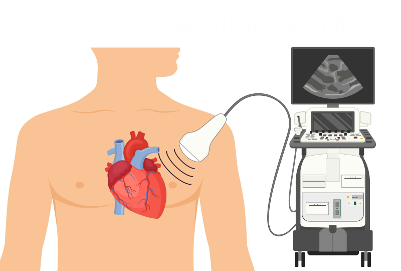 رسم توضيحي لجهاز إيكو القلب