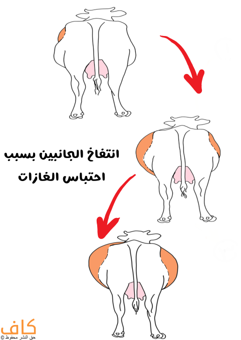 رسم توضيحي لثلاث بقرات لديهم انتفاخ في البطن، الأولى لها انتفاخ بسيط في جانب واحد والثانية لديها انتفاخ كبير في الجانبين والثالثة لديها انتفاخ اكبر بكثير في الجانبين